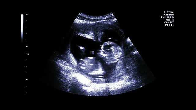 When Are Women Most Fertile? Getting Pregnant by Age & Cycle Date