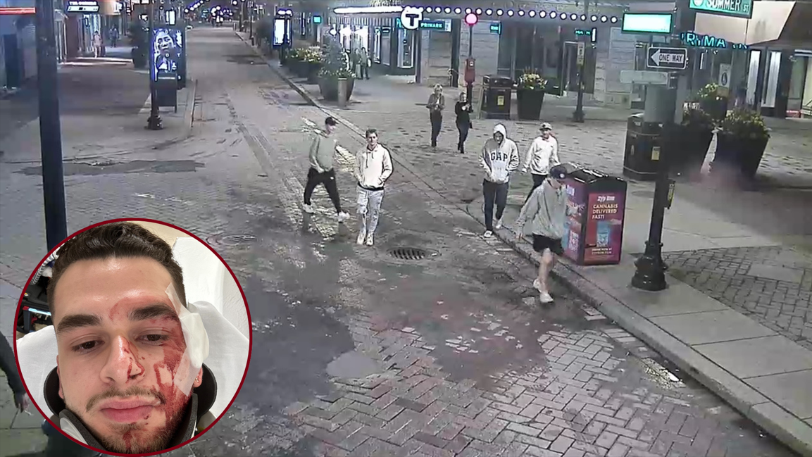 Boston police searching for suspects in assault of Suffolk University student