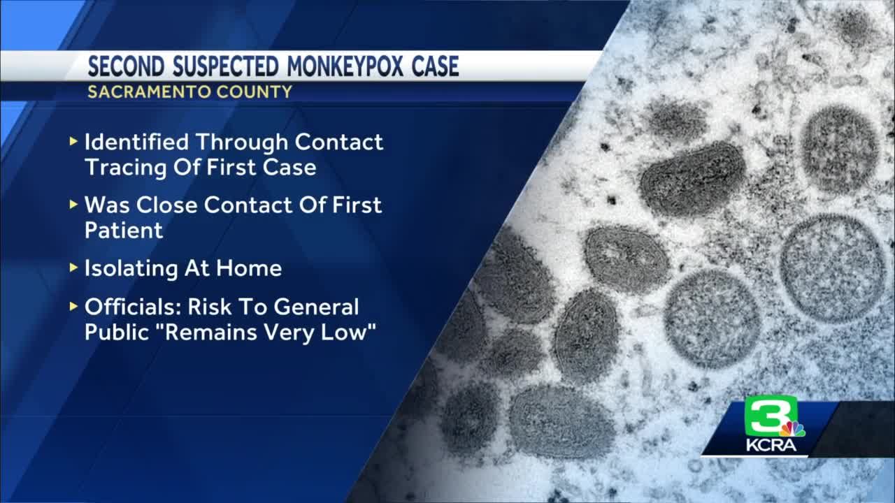 State and local public health officials say risk of Monkeypox remains very  low
