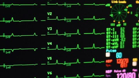 preview for FDA Recalls 465,000 Pacemakers Because of Hacking Fears