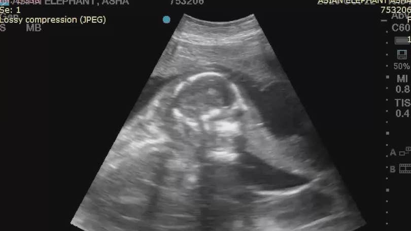 Watch Okc Zoo Shares Ultrasound Video Of Baby Elephant Due In February 22