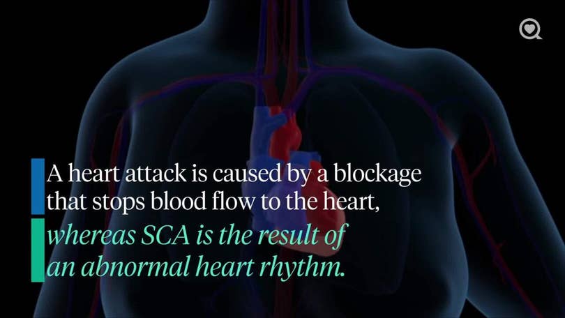 Expert Insights into Bronny James' Cardiac Arrest Recovery