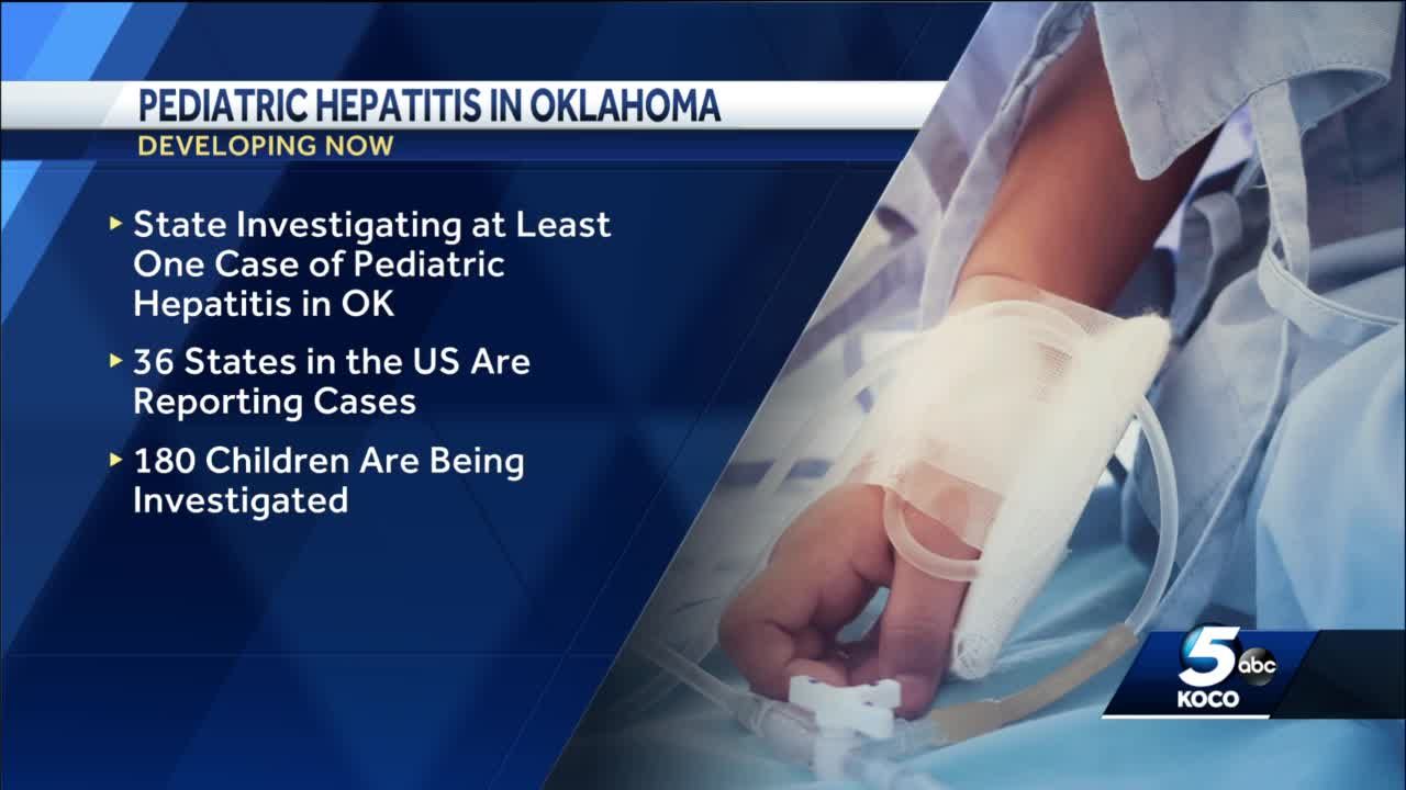 Oklahoma health leaders investigate at least one case of pediatric hepatitis