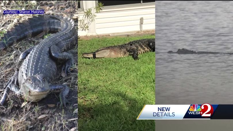 Florida man loses leg in alligator attack