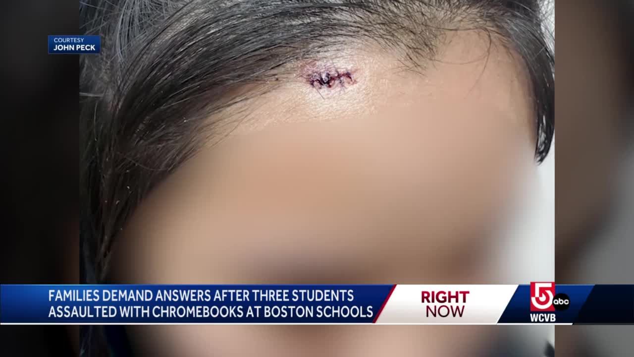 Mother suing Boston schools after she says daughter beaten by bully with Chromebook