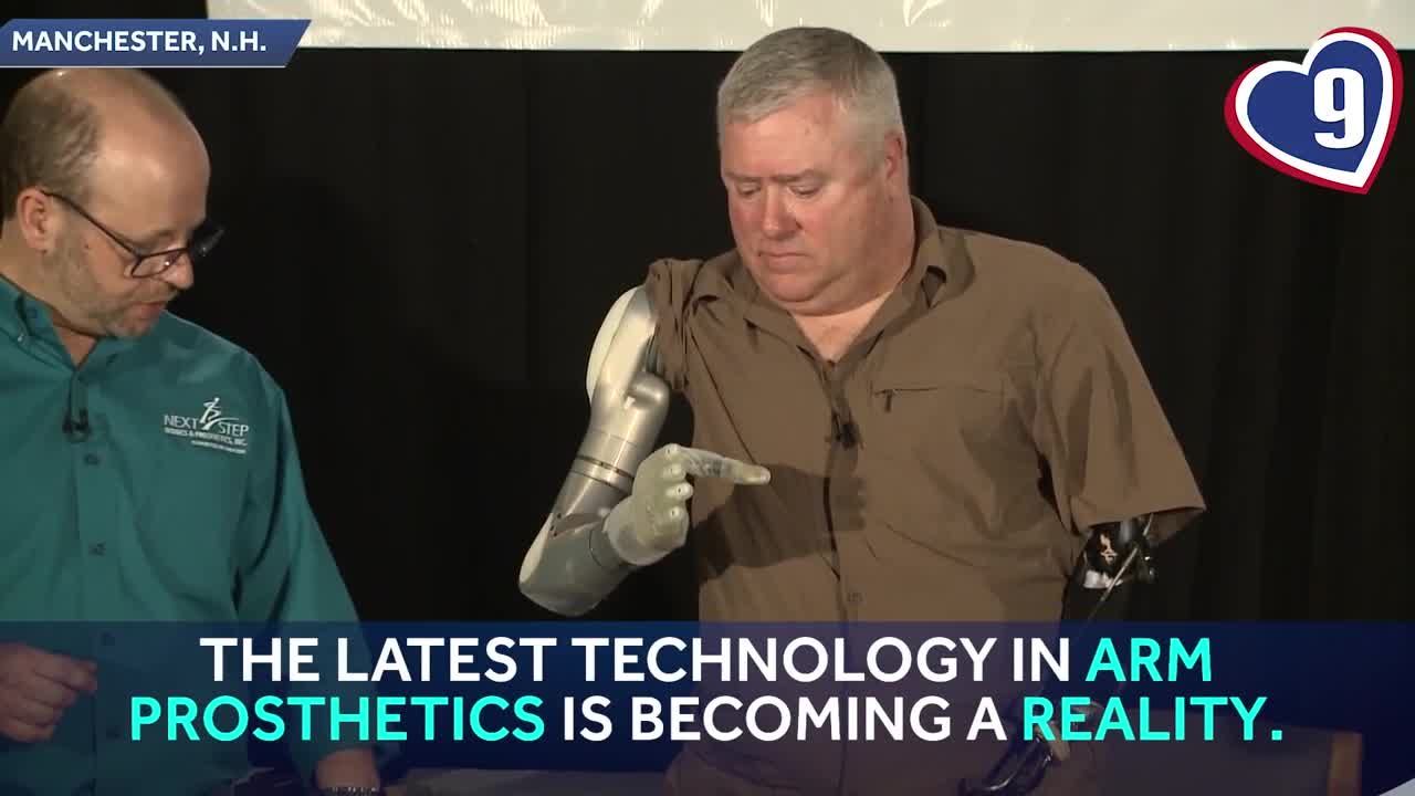 9 Loves: New advanced prosthetic arms unveiled in Manchester