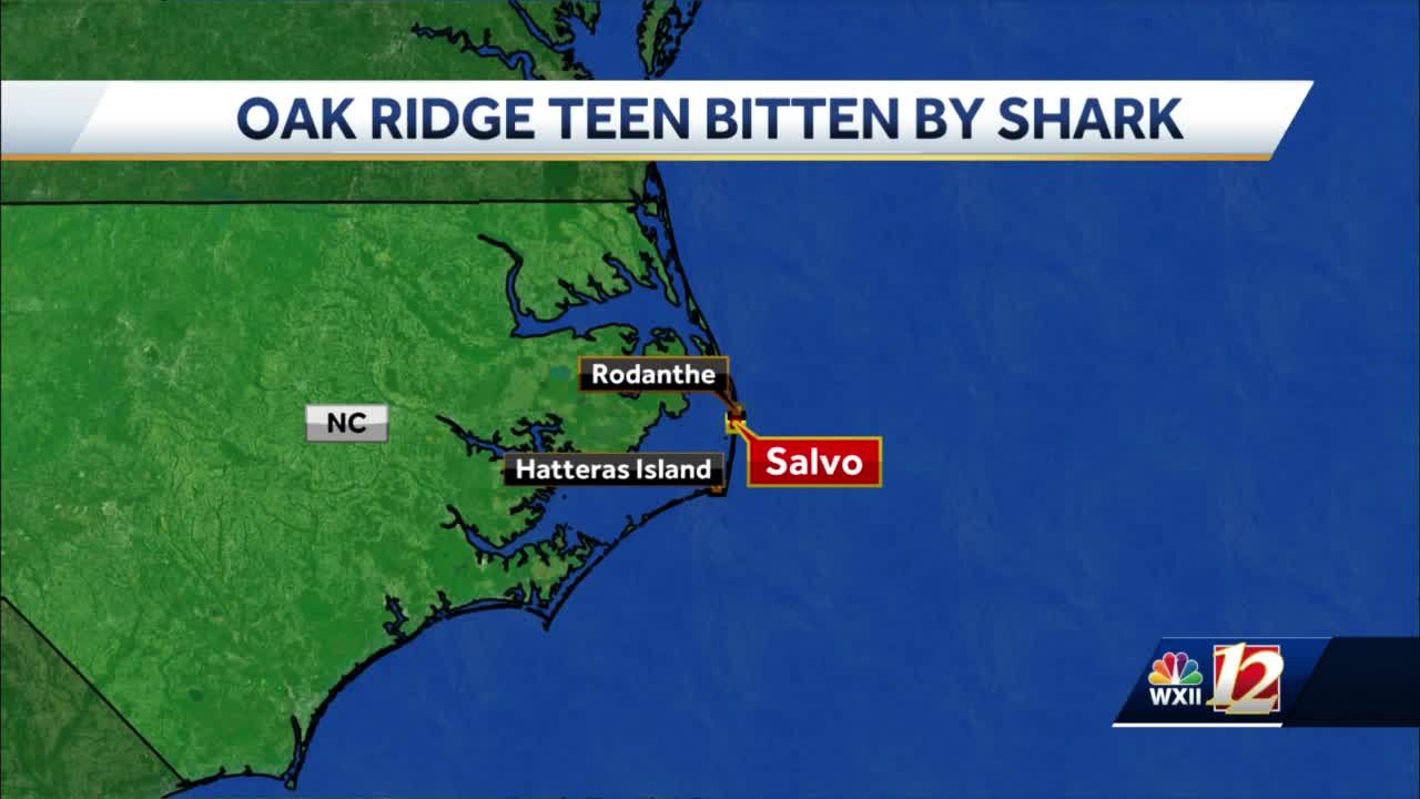 Oak Ridge Teen Bitten By Shark Near Cape Hatteras Shore Results In