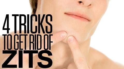 preview for 4 Tricks to Get Rid of Zits