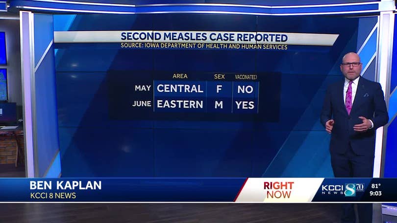 Second measles case reported in Iowa