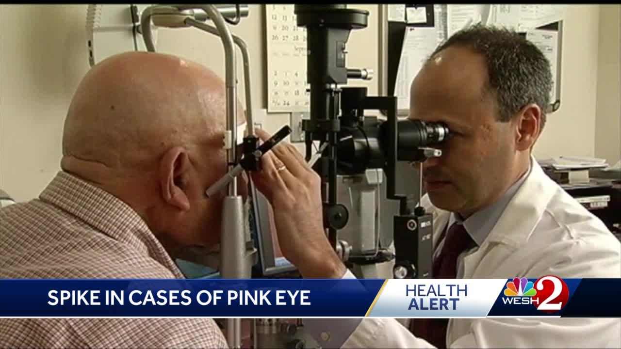 Hot days trigger surge in pink eye cases; doctors caution against  self-medication