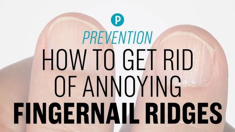 preview for How to Get Rid of Annoying Fingernail Ridges
