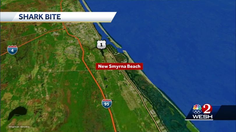 Child Bitten By Shark In New Smyrna Beach Safety Officials Say