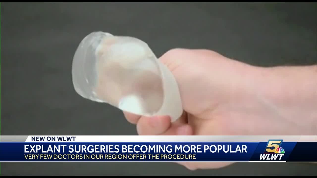 Thousands of women say breast implants making them sick seek to