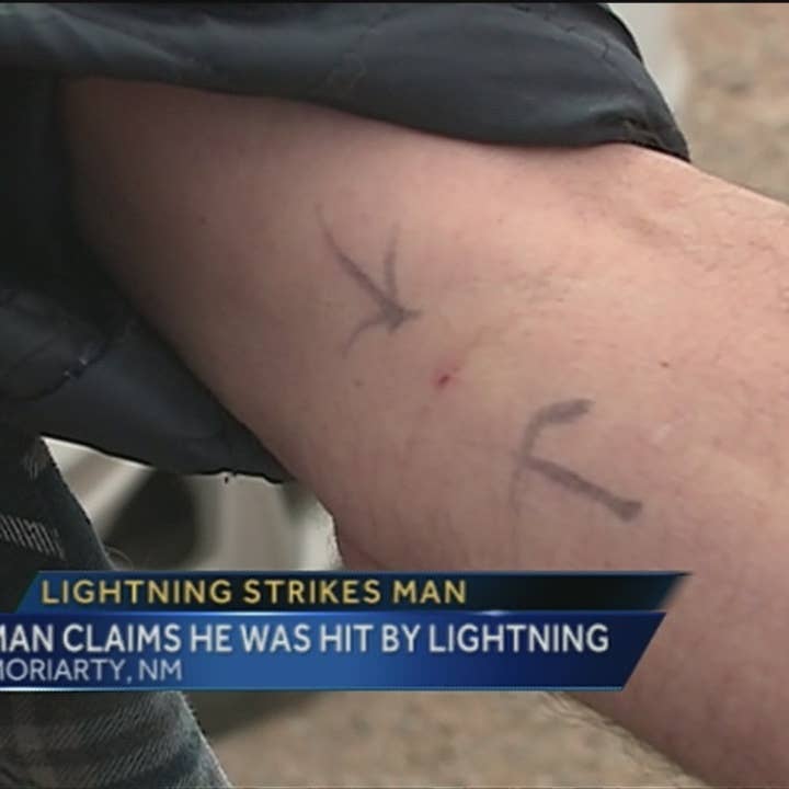 Man Struck by Lightning