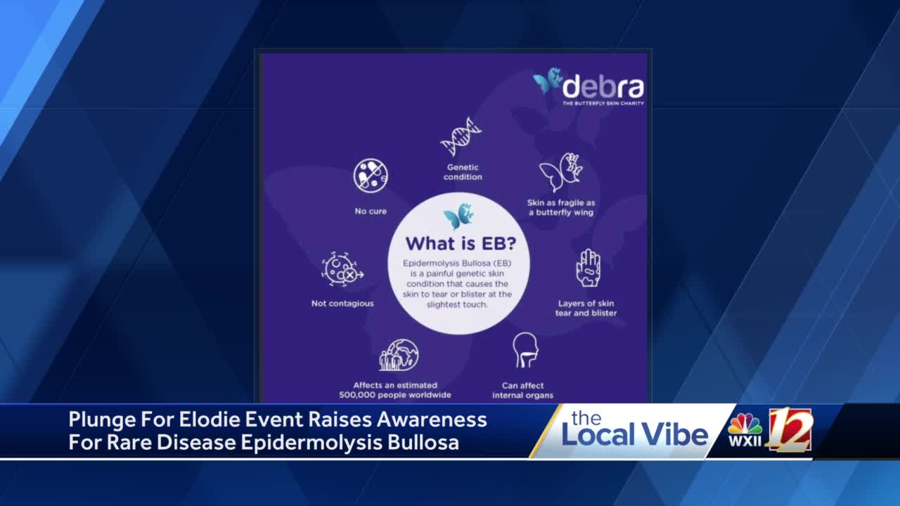 Plunge For Elodie event funds research for rare disease