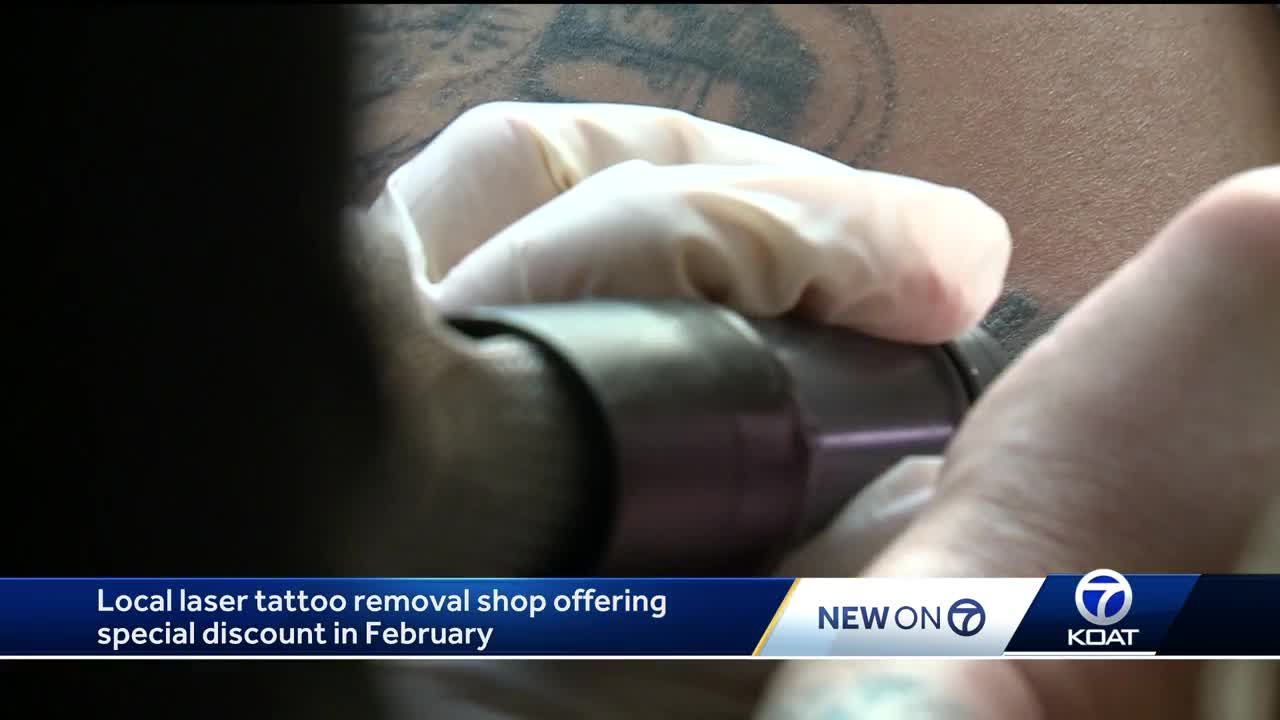 PiQo4 Laser Tattoo Removal | Beverly Hills Location - YouTube