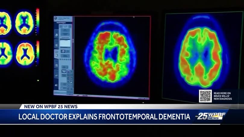 Bruce Willis' type of dementia one of several forms that can