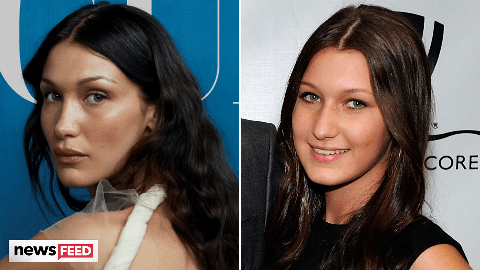 preview for Bella Hadid Admits To Having THIS Procedure At 14 Years Old!