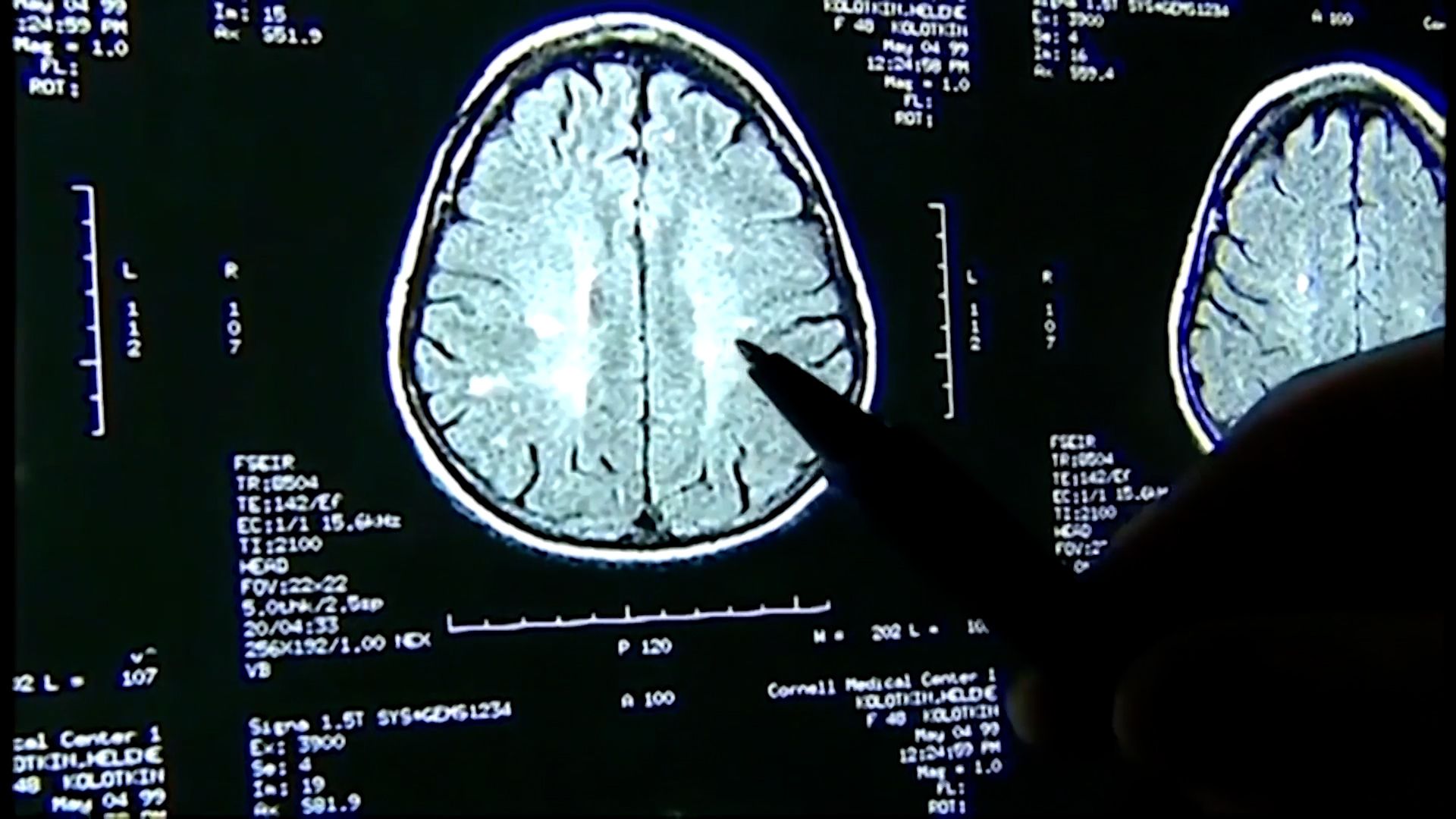 Boogaard's brain donated to Boston University