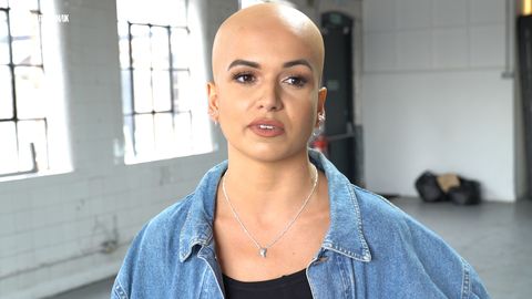 preview for 6 Women on living with alopecia