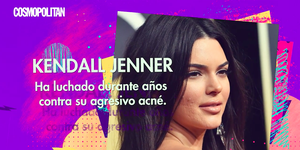 kendall jenner luchando contra acne adulto