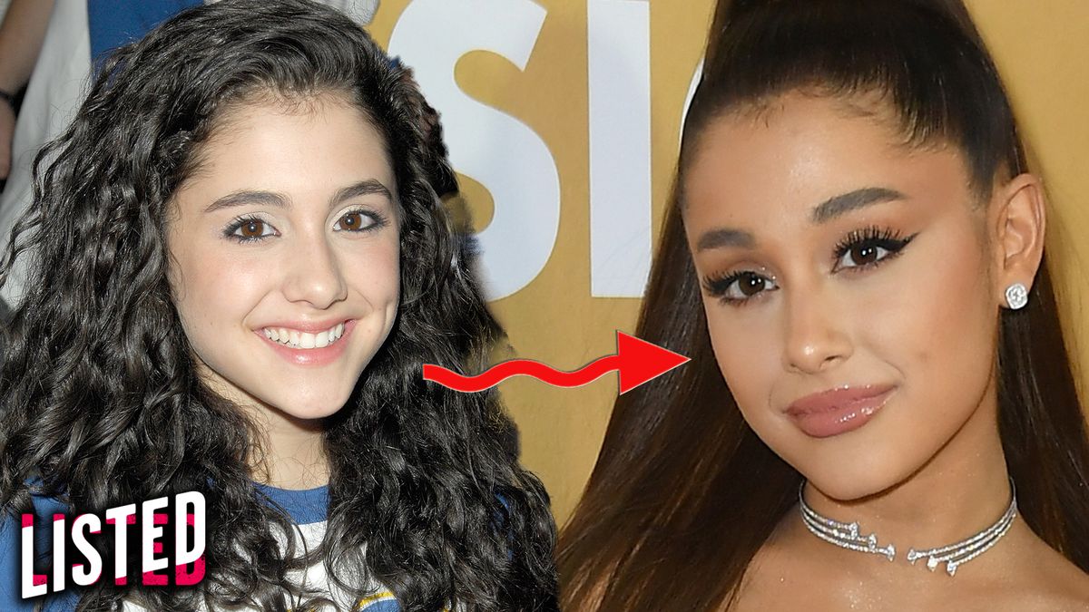 preview for 9 Best Celebrity Glow-Ups