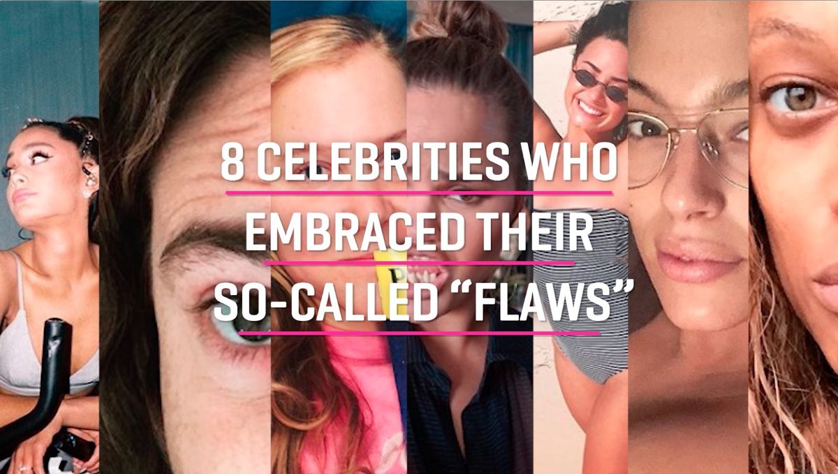 preview for Celebrities embracing their "flaws" on Instagram
