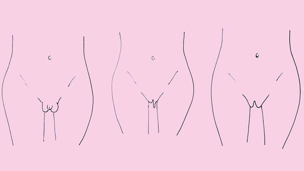 preview for Estos son los 7 tipos diferentes de vulva