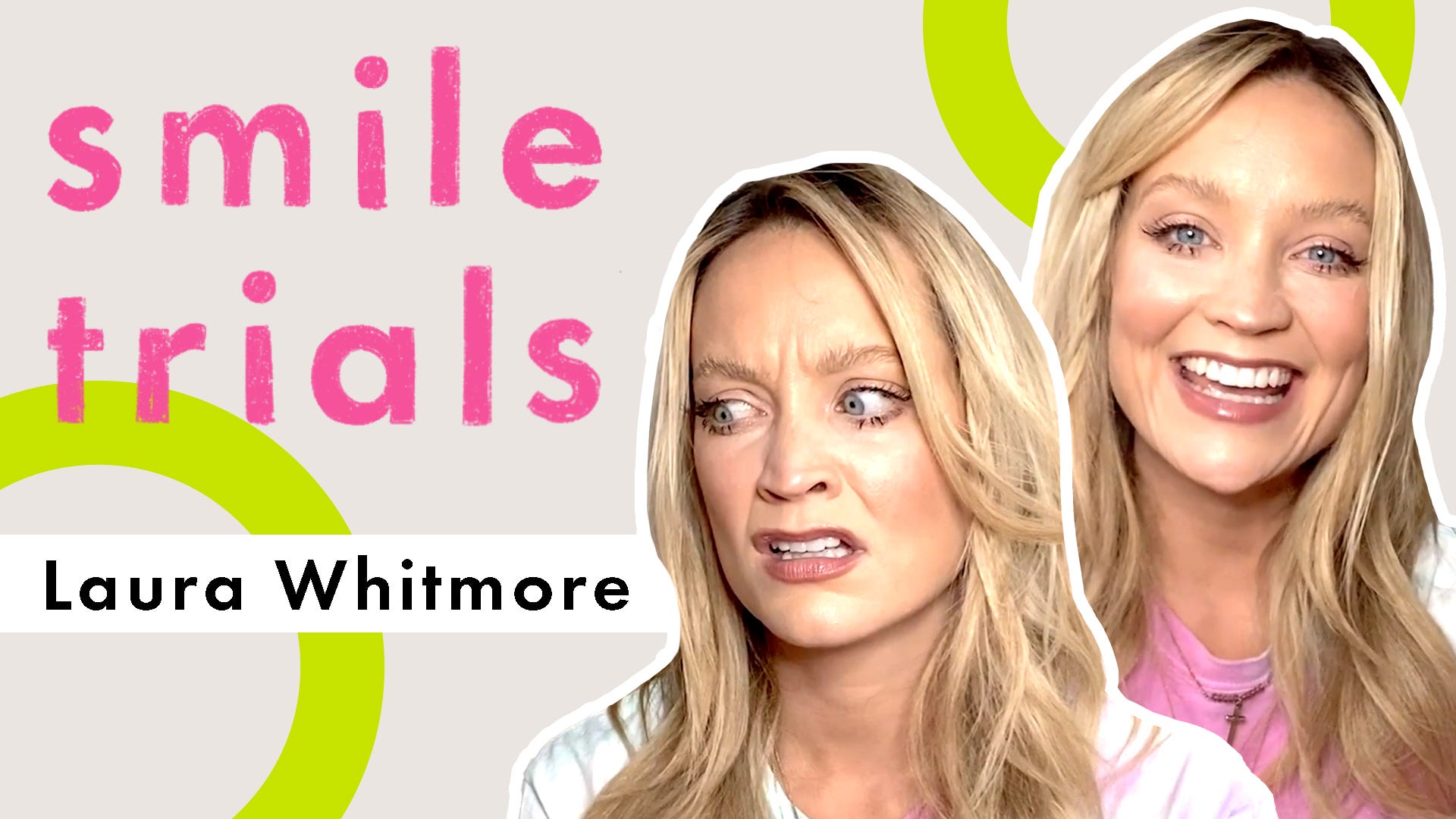 Smile Trials: Laura Whitmore