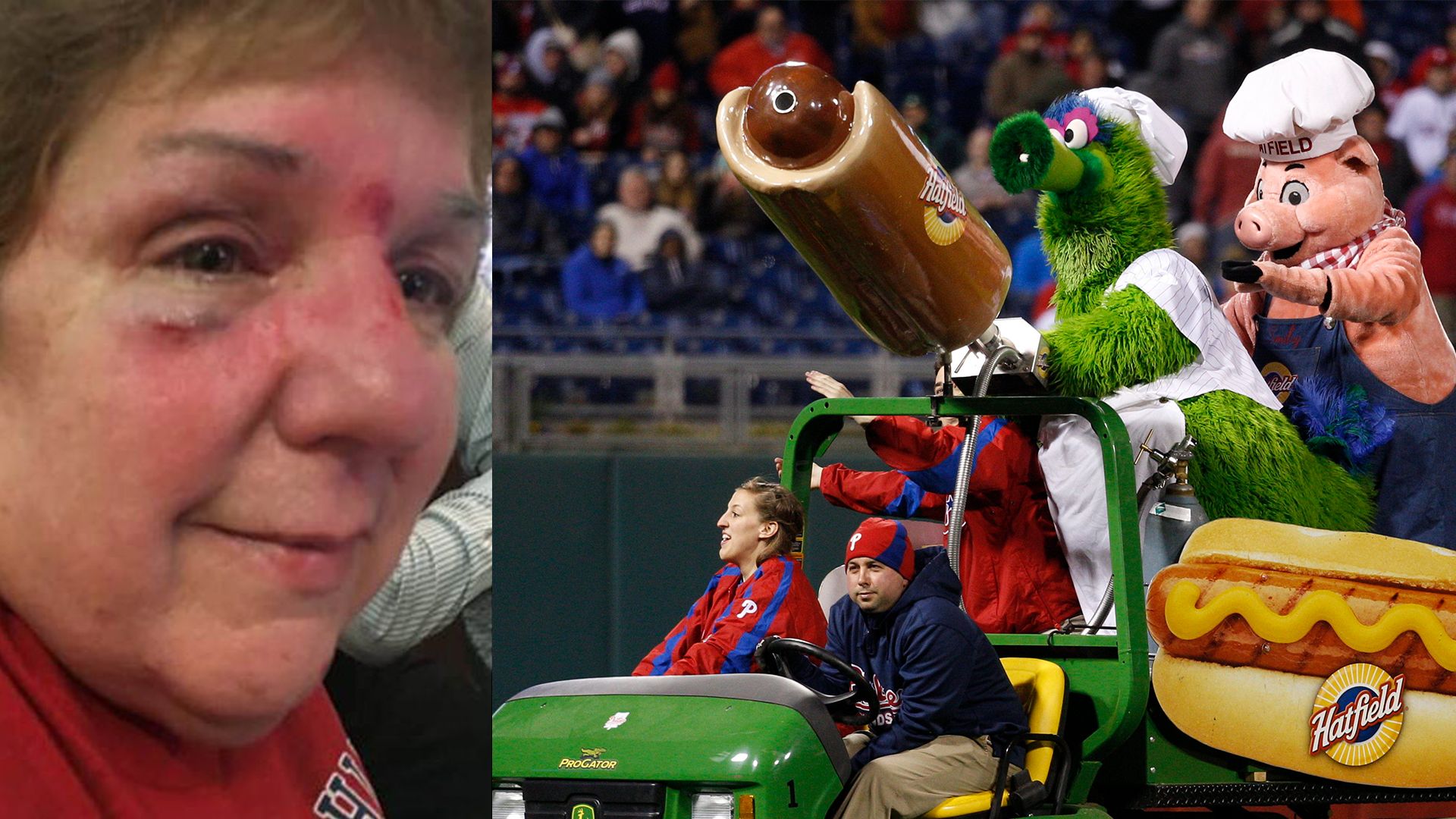 Phillies fan injured after Phillie Phanatic's flying hot dog hit