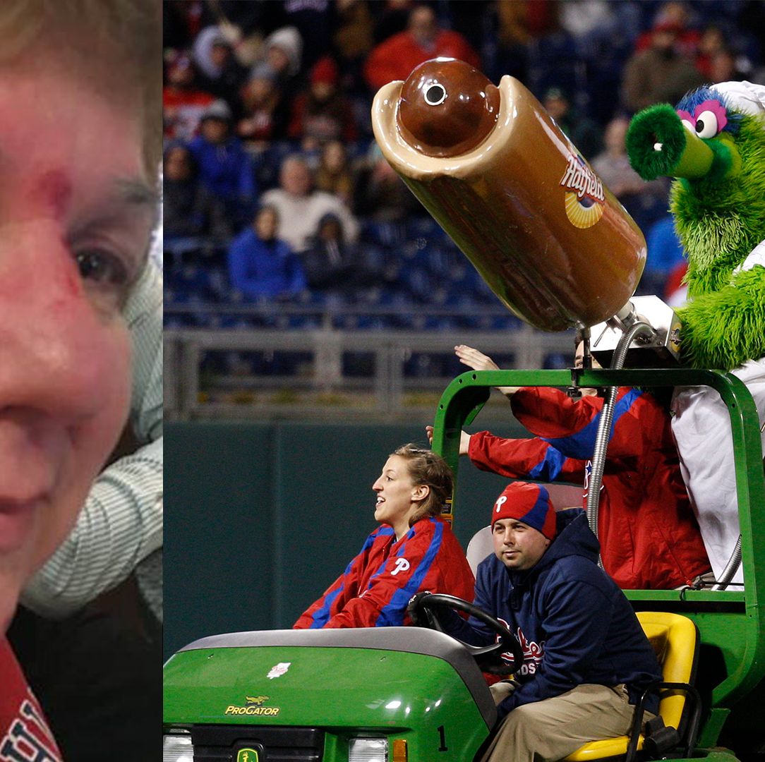 Phillie Phanatic's flying hot dog injures woman
