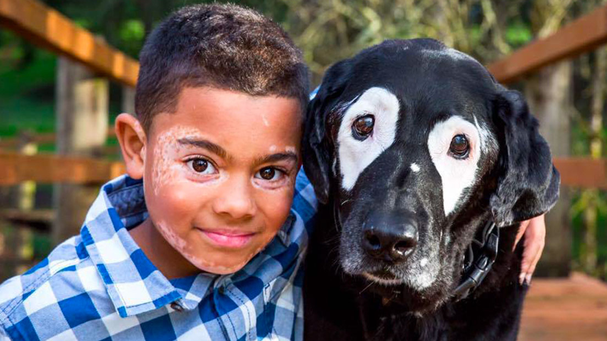 preview for A Boy Befriended a Dog With the Same Rare Skin Condition As Him