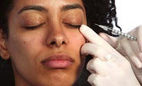 preview for 6 Women Cure Their Dark Circles with Fillers | Harper's BAZAAR