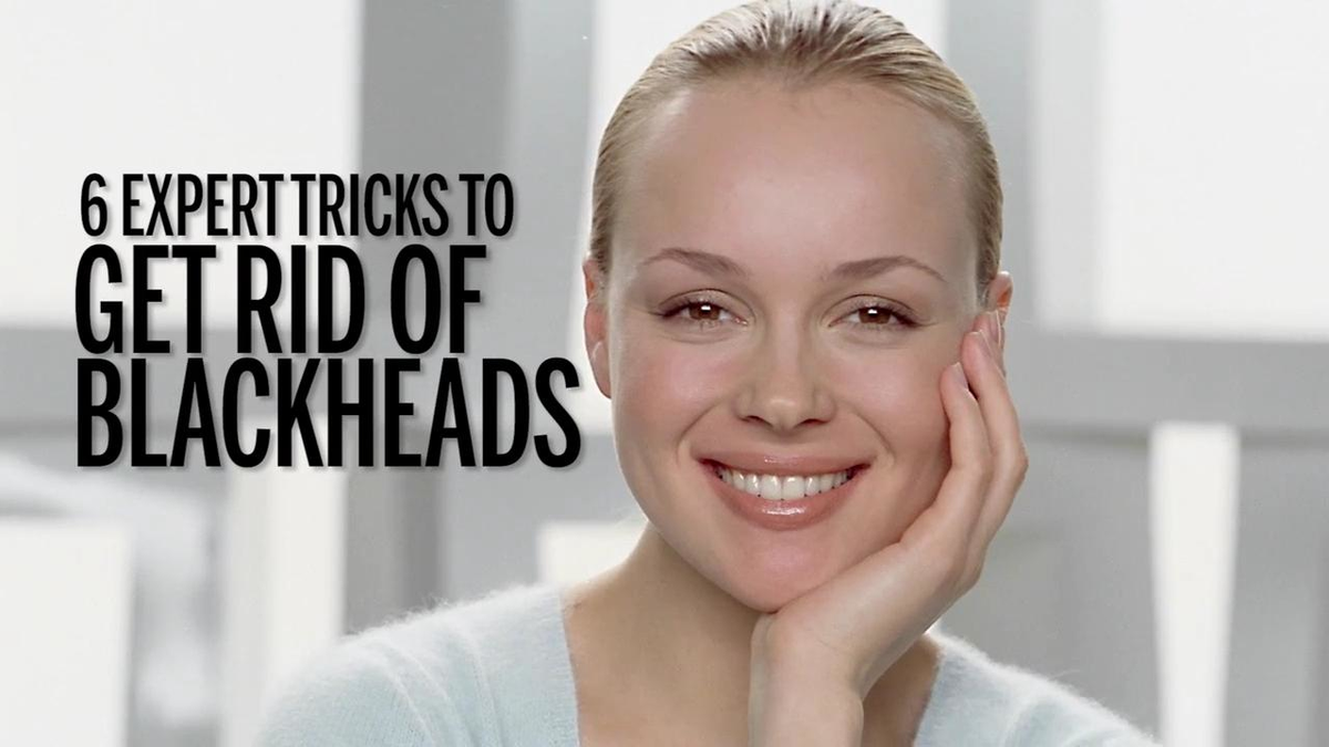 preview for 6 Expert Tricks to Get Rid of Blackheads