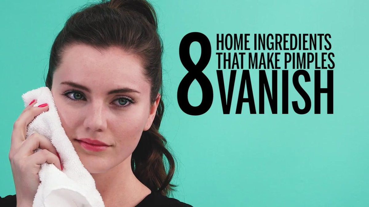 preview for 8 Home Ingredients that Make Pimples Vanish