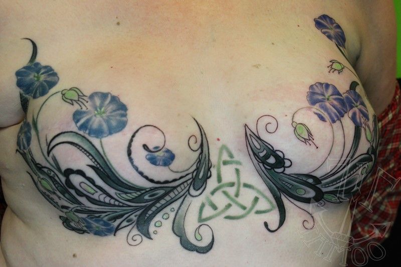 Temporary Tattoos Transform the Scars Left by Cancer