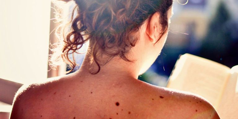 mole stranger melanoma woman cancerous finding cancer