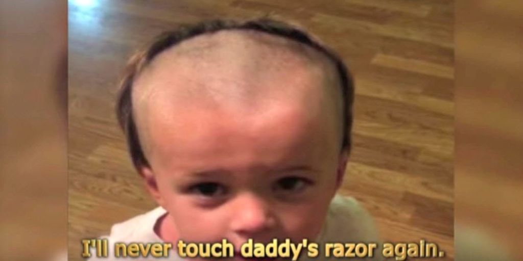 This Little Boy Accidentally Gave Himself a Receding Hairline