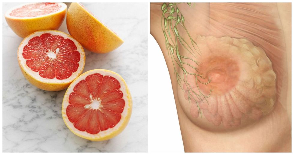 Foods That Look Like the Body Parts They're Good For Gallery-1468206322-picmonkey-collage-11