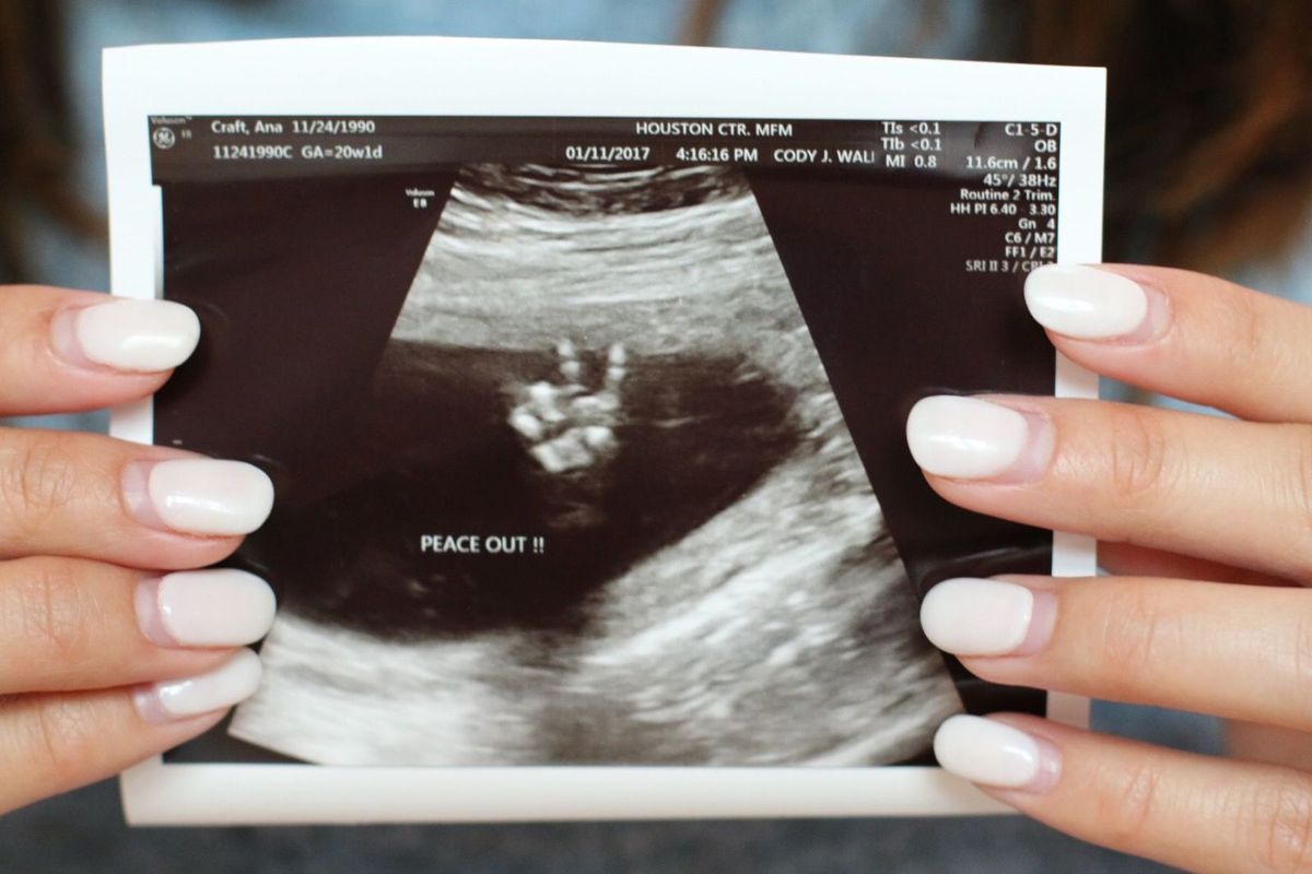 baby ultrasound peace sign