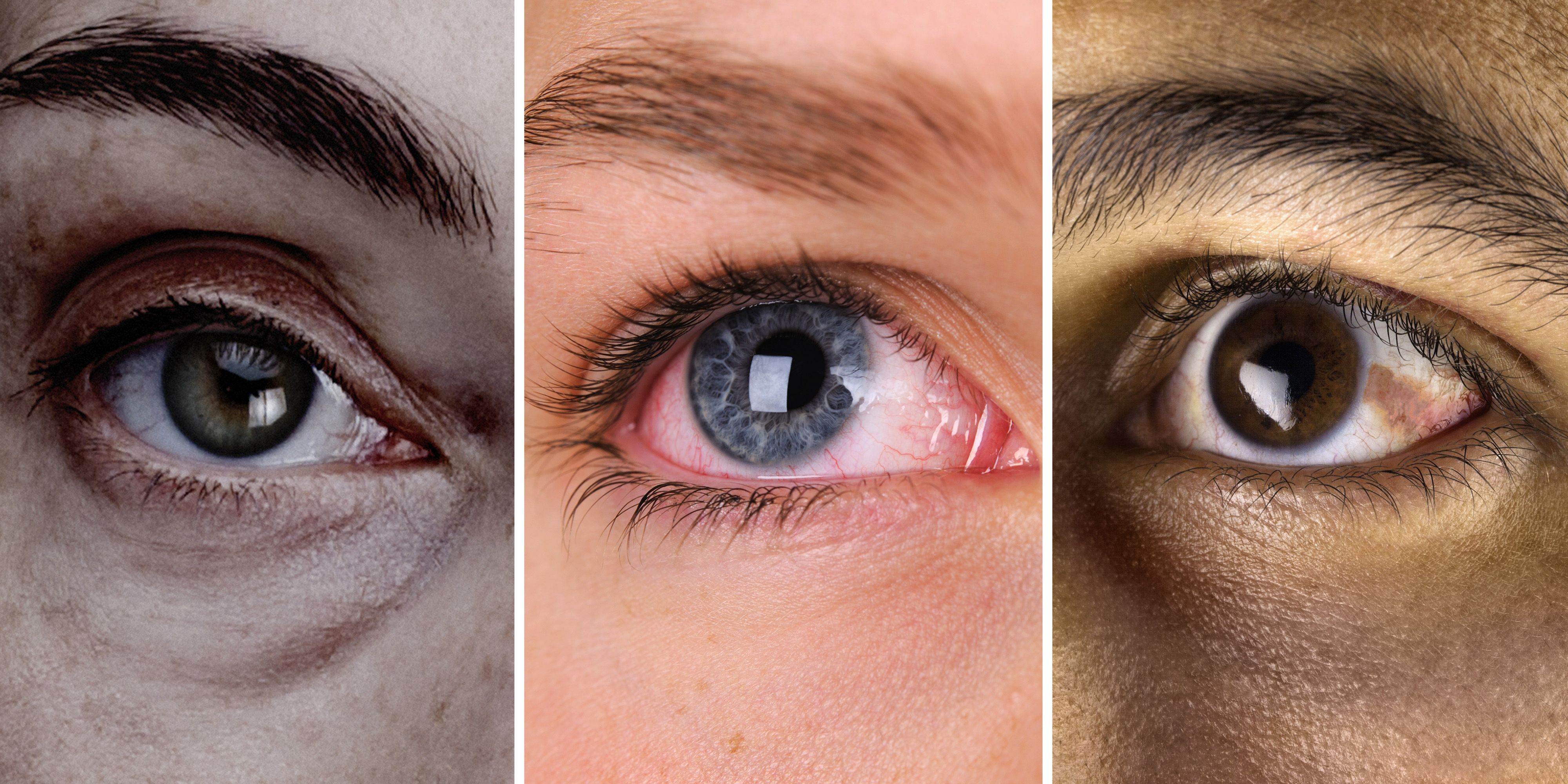 Eye Health: The Warning Signs To Watch Out For forecasting Eye Health: The Warning Signs To Watch Out For advise