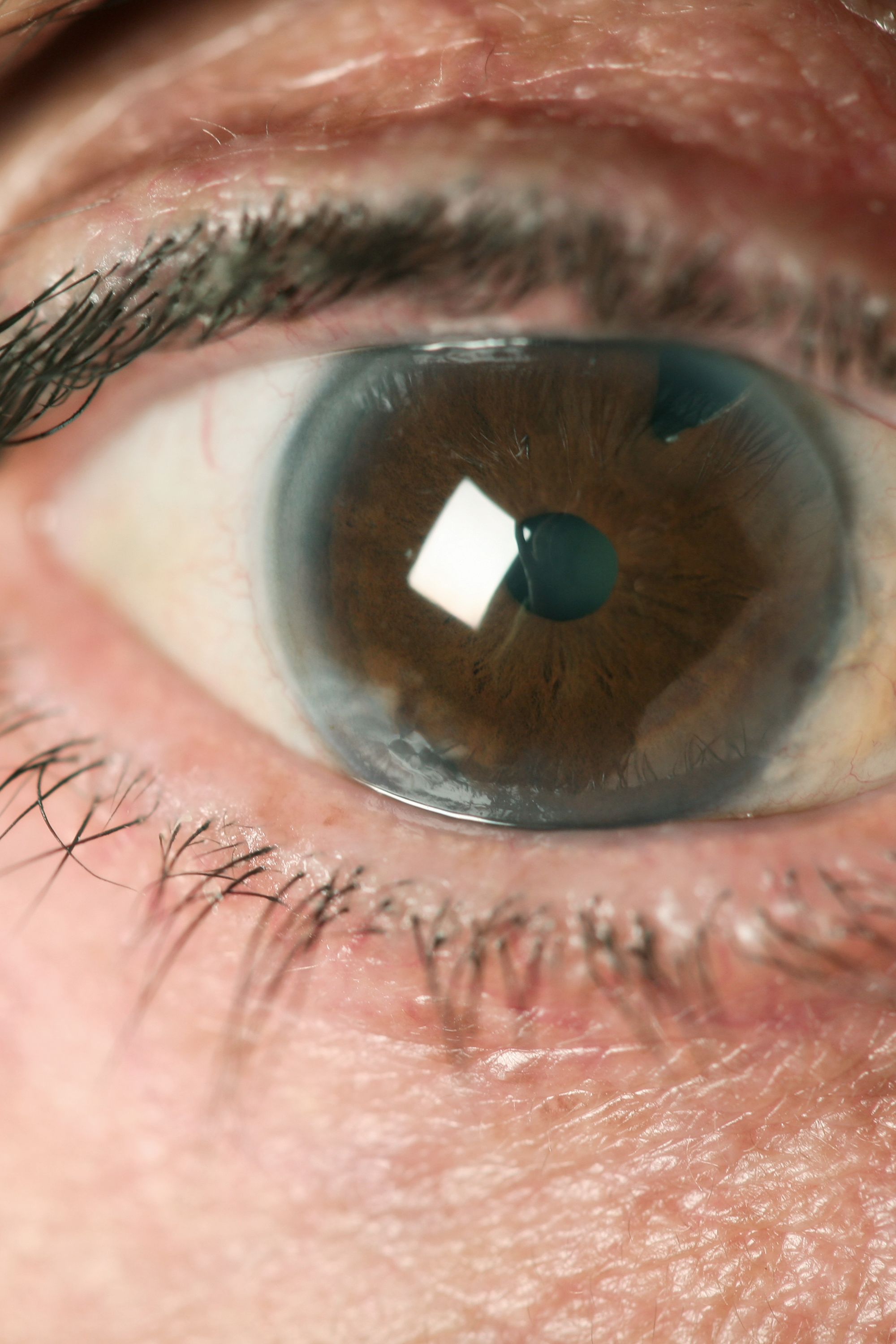 Communication on this topic: Eye Health: The Warning Signs To Watch , eye-health-the-warning-signs-to-watch/ Communication on this topic: Eye Health: The Warning Signs To Watch , eye-health-the-warning-signs-to-watch/