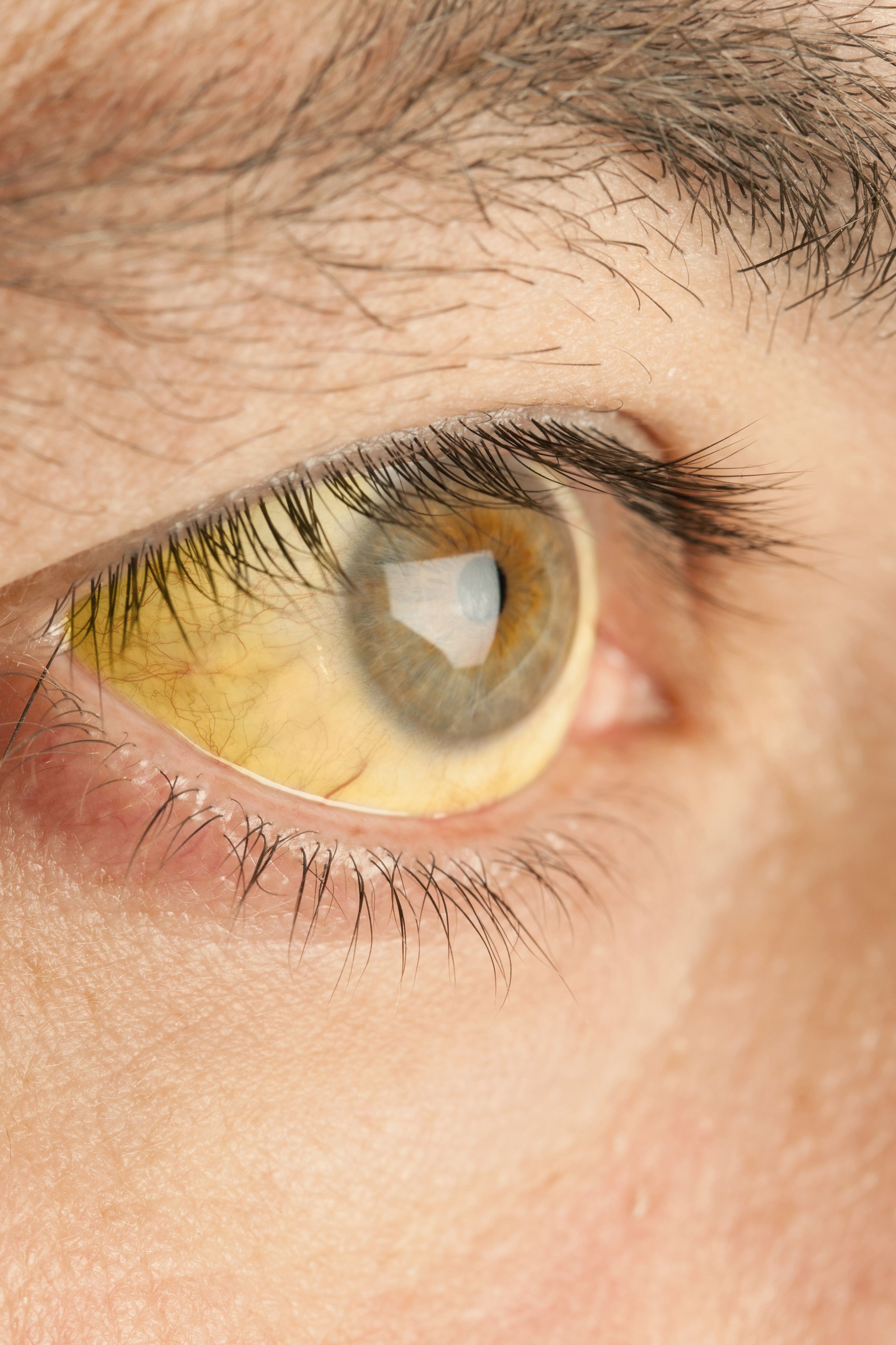 Watch Eye Health: The Warning Signs To Watch Out For video Watch Eye Health: The Warning Signs To Watch Out For video