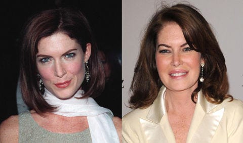 Plastic Surgery Gone Wrong Bad Celebrity Plastic Surgery Plastic Surgery Gone Wrong Bad Celebrity Plastic Surgery