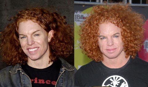 Plastic Surgery Gone Wrong Bad Celebrity Plastic Surgery Plastic Surgery Gone Wrong Bad Celebrity Plastic Surgery