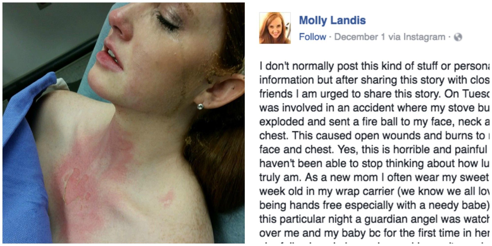 https://hips.hearstapps.com/womansday/assets/16/49/1481058539-moms-viral-message-about-wearing-child-cooking-burns-warning.jpg